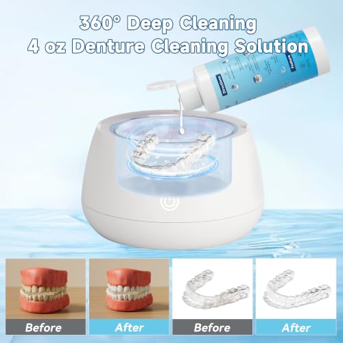Image of Ultrasonic Retainer Cleaner Solution for Ultrasonic Denture Cleaner-Professional Cleaning of Retainers, Invisible Aligners, Mouth Guards, Night Guards, Remove Odors, Discoloration & Stains 4oz
