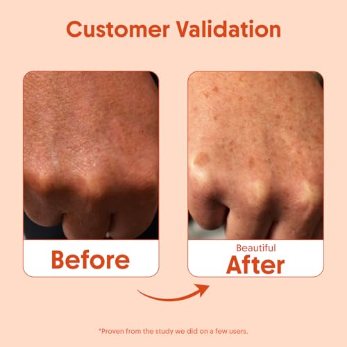 Image of Aravi Organic Oil-Free Sunscreen Body Lotion SPF 50 PA++++ With New-Age UV Filters | (In-Vivo) Dermatologically Tested | Hydrating, Lightweight & No White Cast | UVA /UVB & Blue Light Protection | Niacinamide & Hyaluronic Acid | Sunscreen For Oily & Dry Skin | 100ml