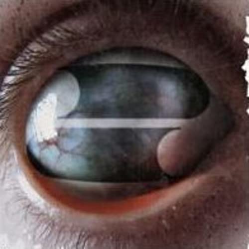 Crazy Eyes (4 LP)