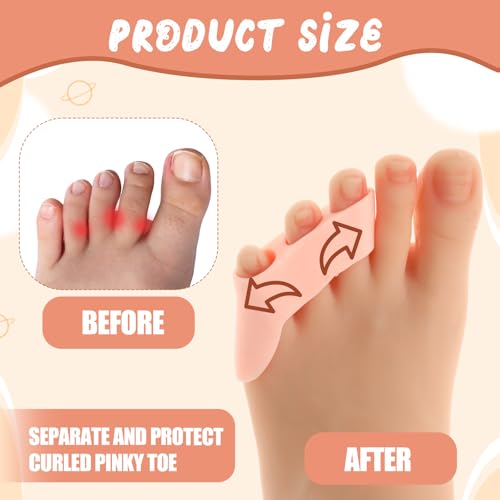 Image of 8 Pcs Pinky Toe Separator Bunion Corrector Toe Spacers Little Toe Protectors Pain Relief Cushions Soft Bunion Pads for Men Women Overlapping Toe Curled Pinky Toes Preventing Rubbing Relieve Pressure