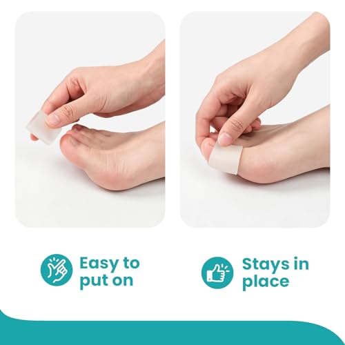 Image of Silicone Toe Protectors - 12 Pack Silicone Toe Sleeve for Hammer Toes, Corns, Calluses, Blisters - Soft Gel Toe Tube Pads for Pain Relief(Large Sizes, Clear)