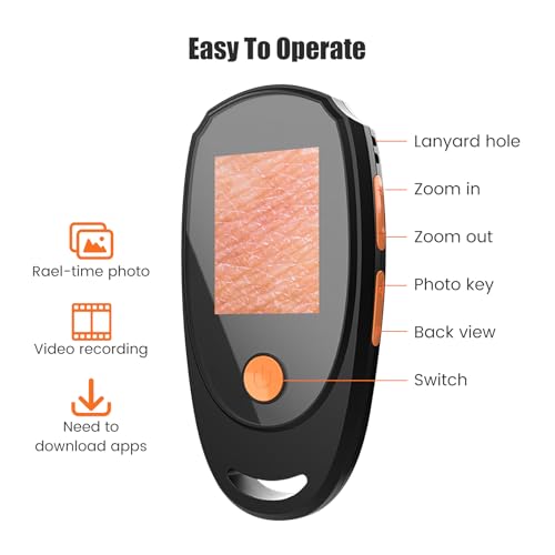 Image of Handheld Dermatoscope Skin Analyzer Machine, Wireless Portable Digital Microscope with 1080P IPS Screen 8 LEDs, 500X Magnifier, for Scalp /Hair Trichomes