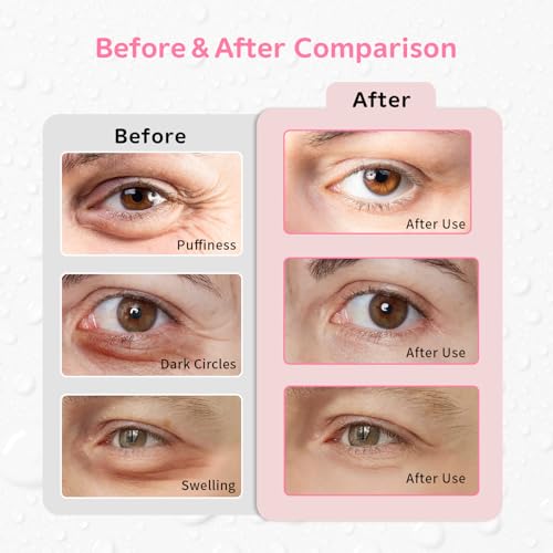 Image of 4PCS Gel Eye Ice Pack Set, Cold & Hot Compress, Reusable Cooling Gel Pads for Strain Relief, Relaxation, SPA and sleep(Butterflies)