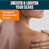 Nuvadermis Scar Care Bundle - Advanced Scar Gel & Silicone Scar Sheets