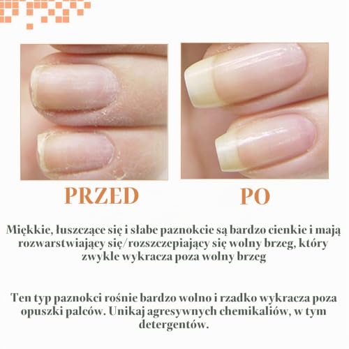 NailTek Foundation II - .5 oz by Nail Tek