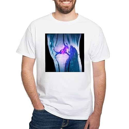 CafePress Anterior Cruciate Ligament Tear, CT Scan T Shirt Men's Traditional Fit Casual T-Shirt White