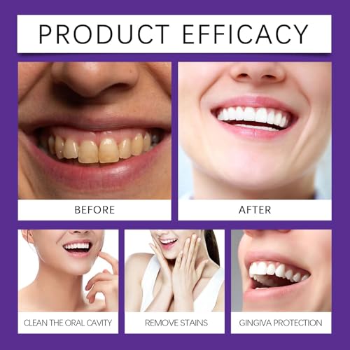 Zahnpulver Gegen Verfärbungen, 2 Stück Teeth Whitening Powder, Zahnreparatur Mineralpuder, Zahnweiss Pulver fur Frischer Atem, Effektiv bei der Stärkung von Zähnen und Zahnfleisch (100G)
