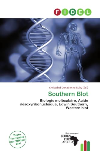 Southern Blot: Biologie moléculaire, Acide désoxyribonucléique, Edwin Southern, Western blot
