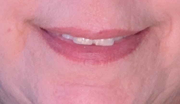 Generic Smooche Hyaluronic Acid Lip Plumper - Hydrating & Volumizing Gloss for Soft, Smooth Lips - Natural Shine & Fine Line Reduction - Cruelty-Free Lip Care