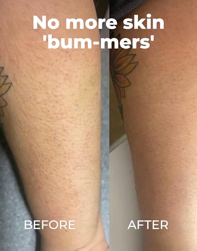 Image of Miami Beach Bum - Bum & Body Cream, Daily Moisturizer, 3.4 oz | Oregano Alose + Jojoba For Razor Bumps & Keratosis Pilaris, Ingrown Hairs & Sunburns, Blemishes & Skin Health