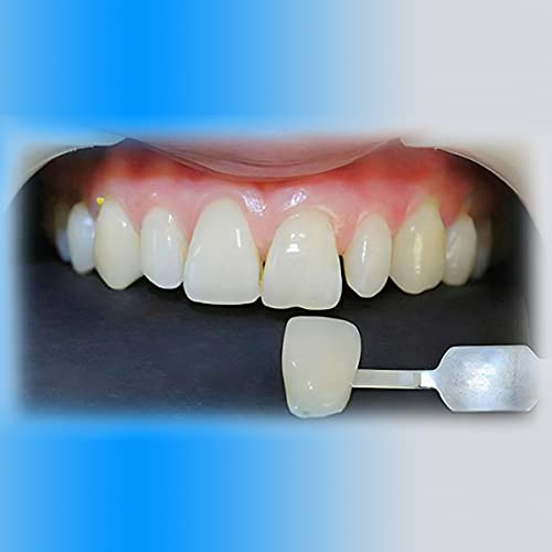 Fake Teeth, Dental Resin Kit For Teeth, Can Be Used For Filling Teeth Missing Teeth, Tooth Kit Diy All Teeth 4 Sets,All Dental Problems Can Be Used Flexibly.comes With Tooth Filling Material. #TOP1