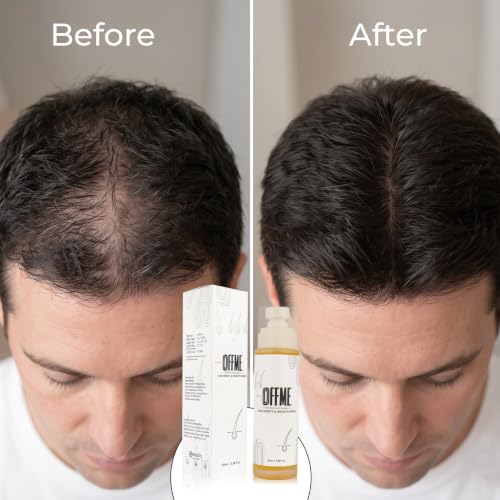 OFFME Hair Density & Hair Growth Serum | With Rosemary, Procapil, Redensyl, Pumpkin Seed Extract, Amla Extract, Bhringraj Extract | Reduces Hair fall | Grows New Hair | For Men & Women, 100ml - Image 3
