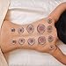 PURAVA Chinese Cupping Therapy Set with Vacuum Pump - Cupping Set for Tension, Back Pain and Cellulite Relief - Set of 12