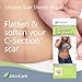 AltroCare Postpartum Silicone Scar Sheets for C-Section. Four Extra-Long (7 inch) Individually Wrapped, Medical Grade Scar Sheets for hypertrophic and Keloid Scars After C-Section (4-Pack).