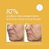 Naturium Tranexamic Topical Acid 5٪ ، العناية بالوجه والجلد ، مع حمض الكوجيك ، Niacinamide & Licorice Root ، 1 أونصة