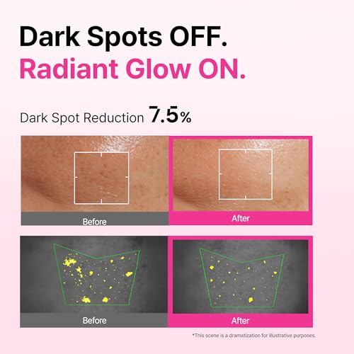 Overlaps Pink Desert Ectoin Glow Serum for Glow-Aging & Radiant Skin, Brightening Serum with Ectoin, Niacinamide & TXA, Lightweight Non-Sticky Korean Skincare for Uneven Tone & Dull Skin, 1.01 fl. oz.