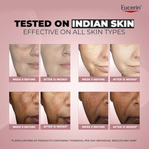 Image of Eucerin Anti-Pigment Face Cream with Thiamidol & SPF 30, Reduces Dark Spots 50ml
