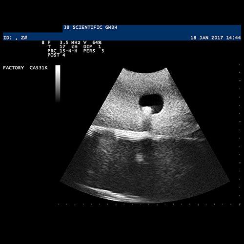 3B Scientific SONOtrain Ultrasound Vein Model