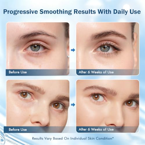 Multipeptide Firming Eye Cream DROPS TO - image 6