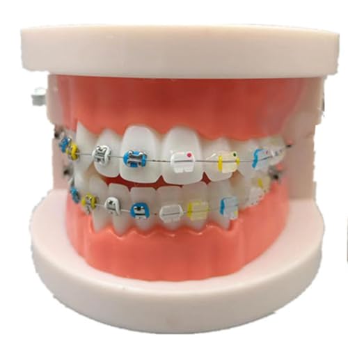 SdaryWare Modelo de demostración de ortodoncia Dental   Modelo de Dientes estándar   Modelo de Tratamiento con Brackets metálicos, Modelo explicativo de Arco de Alambre con Brackets, J,E 8cm