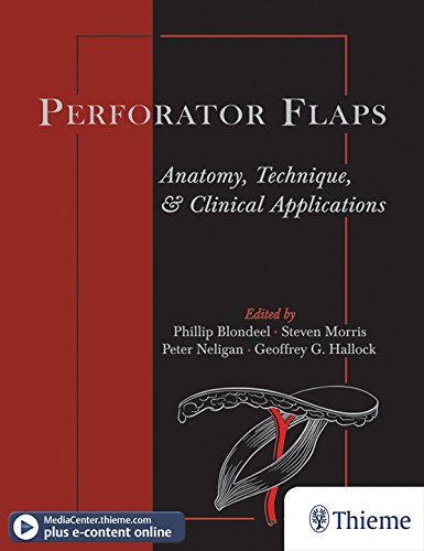 Perforator Flaps: Anatomy, Technique, & Clinical Applications