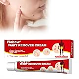 Wart Remover 20g, Effective Verruca Treatment, Corns Spot Moles, Moles and Calluses, Suitable for The Face and Body, Skin tag Remover, to Prevent The Spread of Wa