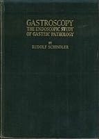 Gastroscopy: The Endoscopic Study of Gastric Pathology, with 89 Text Figures and 96 Color Reproductions of Gastroscopic Observations B0008B316Q Book Cover