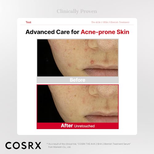 COSRX AHA 2% BHA 2% Blemish Treatment Serum, Quick & Easy Spot Care (50g) | 30+ Cotton Balls, Spot Treatment, Blackheads & Whiteheads, Sebum Control, Paraben Free, Phthalates Free, Korean Skin Care - image 3