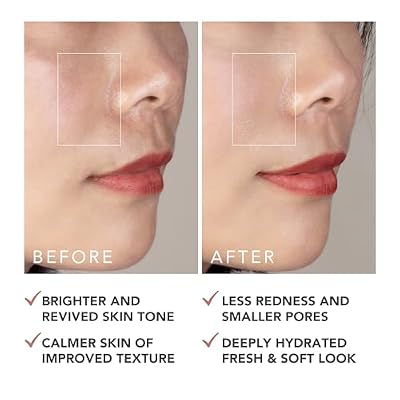 FOREO SUPERCHARGED Barrier Restoring Essence Mist, 3.7 fl oz - Collagen Boosting Spray Moisturiser - Collagen Peptides, Niacinamide, Centella Asiatica, Panthenol - Face Mist For All Skin Types