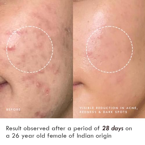 Auli 24k Gold and 5% Niacinamide Hydrating Gel for All Skin Types | Hydrating, Non-Sticky Gel | Age Spots and Reduce Redness | Magic Potion Gold - 60GM