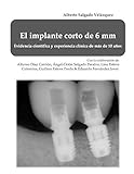  El implante corto de 6 mm: Evidencia científica y experiencia de más de 10 años.