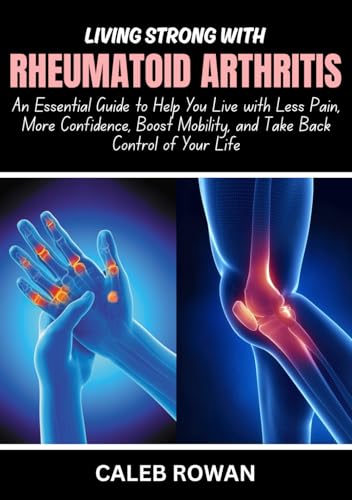 Living Strong With Rheumatoid Arthritis: An Essential Guide to Help