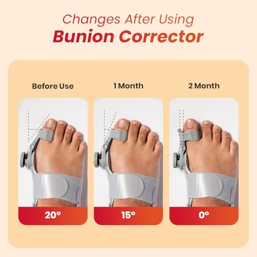 Image of AGEasy Antara Bunion Corrector Orthopedic Toe Straightener with Adjustable Rotating Knob, Universal Fit for both Left and Right Feet (One Size - Pack of 2)