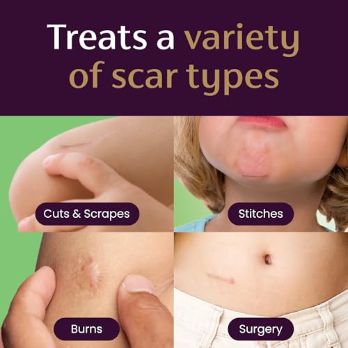 mederma scar gel for kids - reduces appearance of old amp new scars from cuts burns surgery insect bites amp scrapes grape scented goes on purple amp rubs in clear ages 2 070 oz