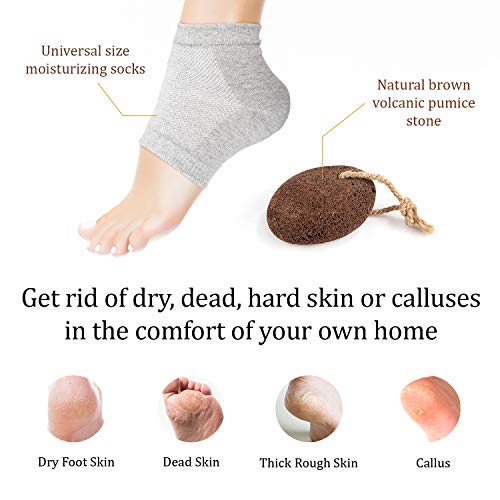 Pumice Stone for Feet & Moisturizing Heel Sleeves - Natural Lava Foot Stone Callus Removing Set - Cracked Heel Treatment - Foot Care Kit for Dry Cracked Feet Body Hands (Brown) (Brown)