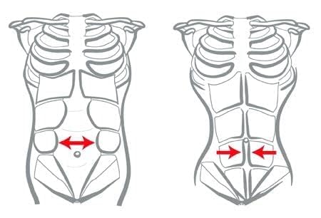 RADE Abdominal Binder, Waist And Stomach Wrap, Hernia And Abdominal Surgery Support, C Section Postpartum Recovery, Core Stabilizer Anti Sciatic Belly Bant For Women And Men (Black, Small)