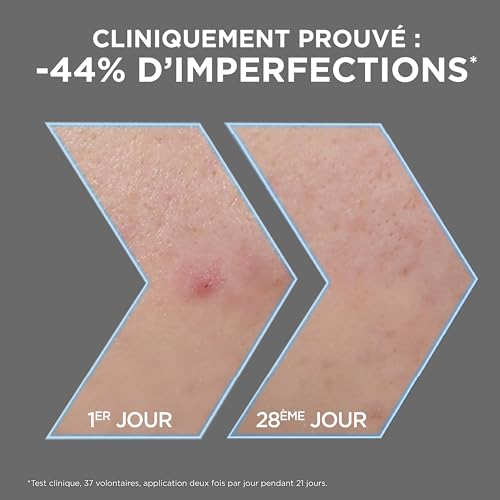 Garnier - Pure Active - Sérum Anti-Points Noirs & Imperfections au Charbon - 4% Niacinamide, Acide Salicylique & Acide Lactique - Peaux Grasses à Tendance Acnéique - Vegan & Cruelty Free - 30 ml – Image 3