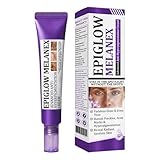 Crème anti-hyperpigmentation pour le visage pour tous les types de peau