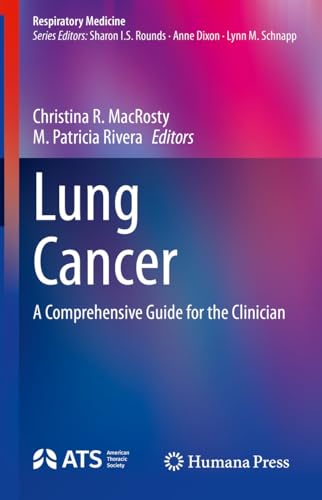 Lung Cancer: A Comprehensive Guide for the Clinician (Respiratory Medicine)