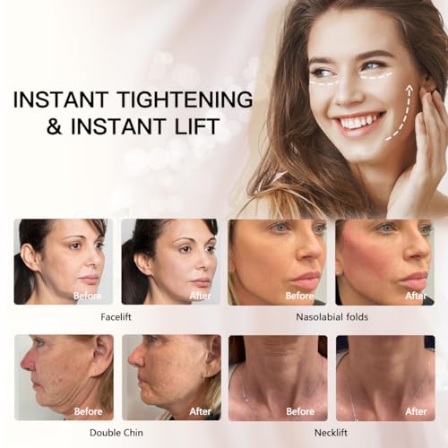 PDO Thread(mono 30G 13MM) Lift/Face Body Lifting/Smooth Mono Screw Type 26G 27G 30G 13mm 38mm 50mm 60mm(50pieces)