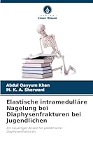 Elastische intramedulläre Nagelung bei Diaphysenfrakturen bei Jugendlichen 6209294707 Book Cover