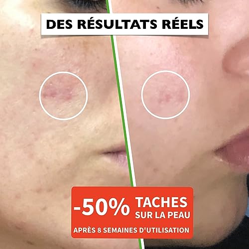 60 ml Bio Sérum Visage à la Vitamine C, Acide Hyaluronique Pur, Vit. E, B5 et Niacinamide. Anti-Rides, Anti-Taches, Anti-âge et Hydratant. Soin Visage Vegan & Cruelty Free.Testé Dermatologiquement – Image 5
