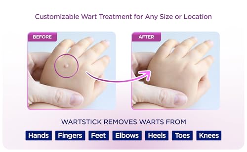 wartstick maximum strength salicylic acid solid-stick common and plantar wart remover 2 pack 04 oz