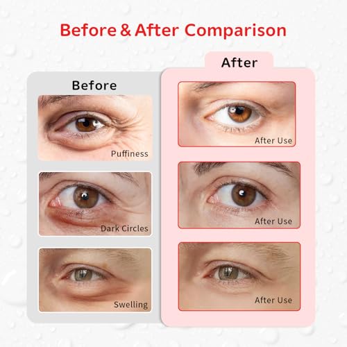 Image of 4PCS Gel Eye Ice Pack Set, Cold & Hot Compress, Reusable Cooling Gel Pads for Strain Relief, Relaxation, SPA and Sleep (4 Apples)
