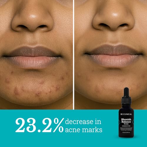 Image of Be Clinical Blemish Balance Serum | For Acne-Prone Skin, Reduces Hyperpigmentation, Fades Acne Marks and Sunspots | Oil Control | Glycolic Acid, Salicylic Acid, LHA