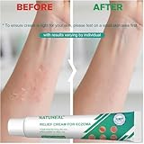 Eczema Cream, Itch Relief Cream Fast Relief for Dermatitis Itchy Rashes, Moisturising Cream for Dry Irritated Eczema-Prone Skin, with Oat, Non-Greasy 20g - Image 7