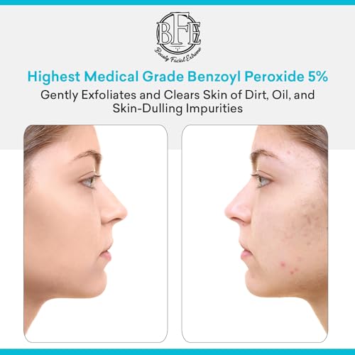 image for Beauty Facial Extreme Acne Face wash Treatment with Benzoyl Peroxide 5