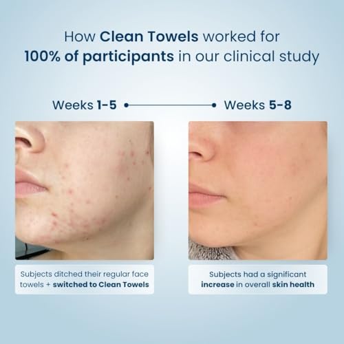 Clean Skin Club Toalhas limpas | Worlds 1ST Toalha de rosto biodegradável | Toalhetes descartáveis p
