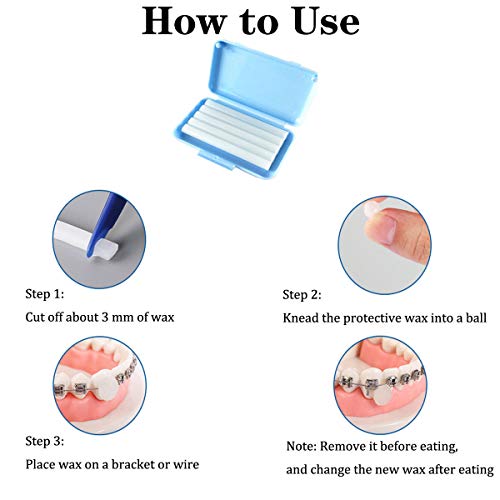 Kiseer 24 Pack Colorful Orthodontic Wax Dental Care Wax For Braces Wearer #TOP3