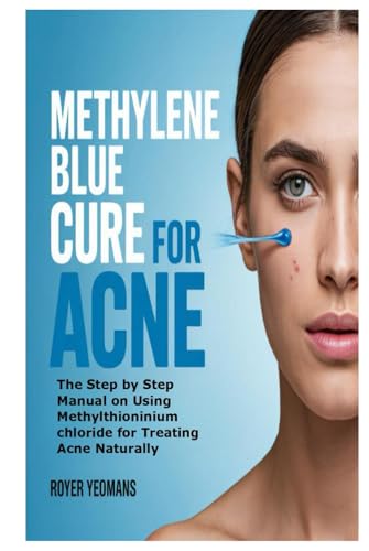 Methylene Blue Cure for Acne: The Step by Step Manual on Using Methylthioninium chloride for Treating Acne Naturally